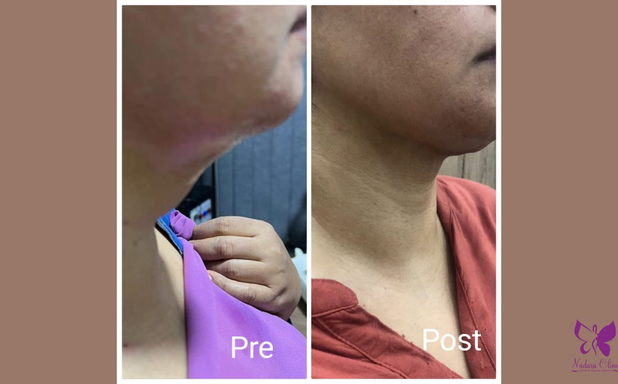 شد الرقبة في الغردقة